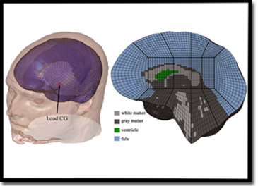 Finite Element Model of Human Brain