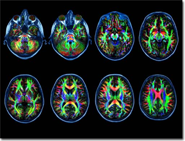Neuro Imaging Pic